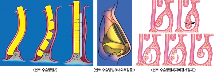 ڼ2,3,4